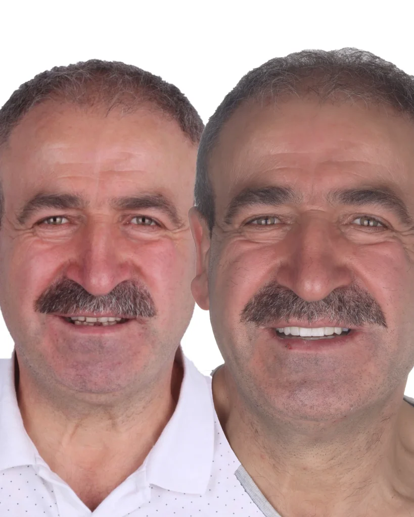 DİLEK kopyası (Conflicted copy from CAN-iPadi on 2024-03-10-10-42-13) ihtilaf