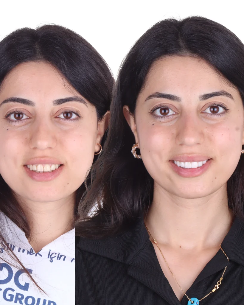 merve çetinkaya (1)